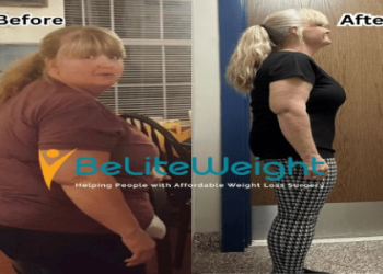 Life After Gastric Sleeve： Real Stories of Regret and Challenges